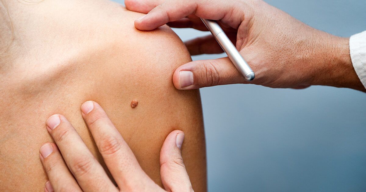 BDD 2025 | Koninklijke Belgische Vereniging voor Dermatologie en Venerologie