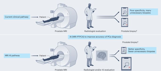 Artificial intelligence for prostate cancer diagnostics - Nature Cancer