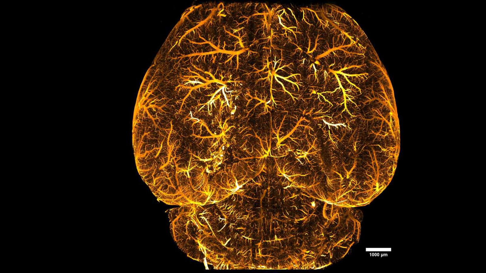 Watching the Brain Learn