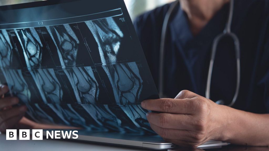 X-ray predicting AI could transform care, Surrey study finds