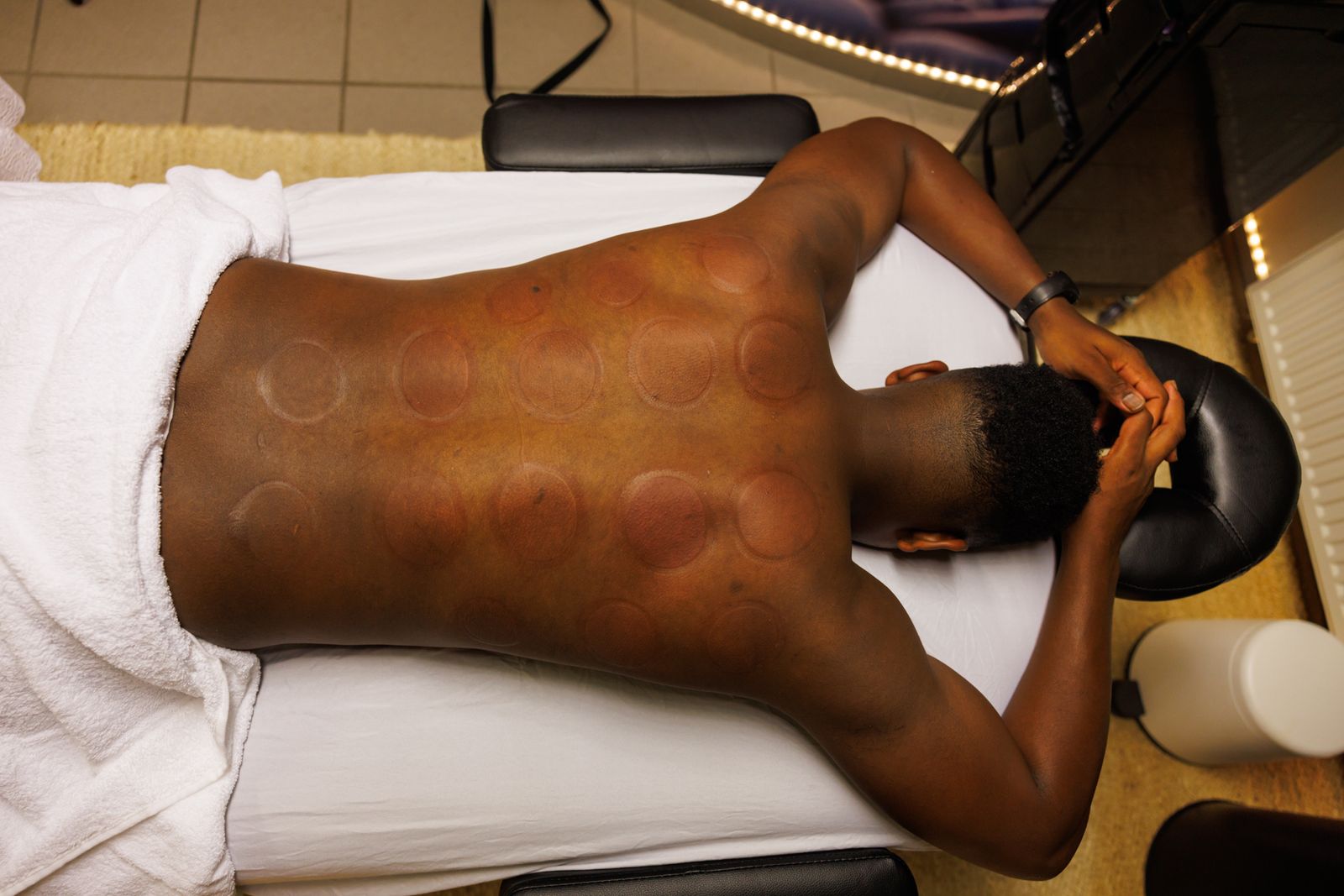 Effect van cupping op je bloedsomloop: waarom kiezen voor cupping?