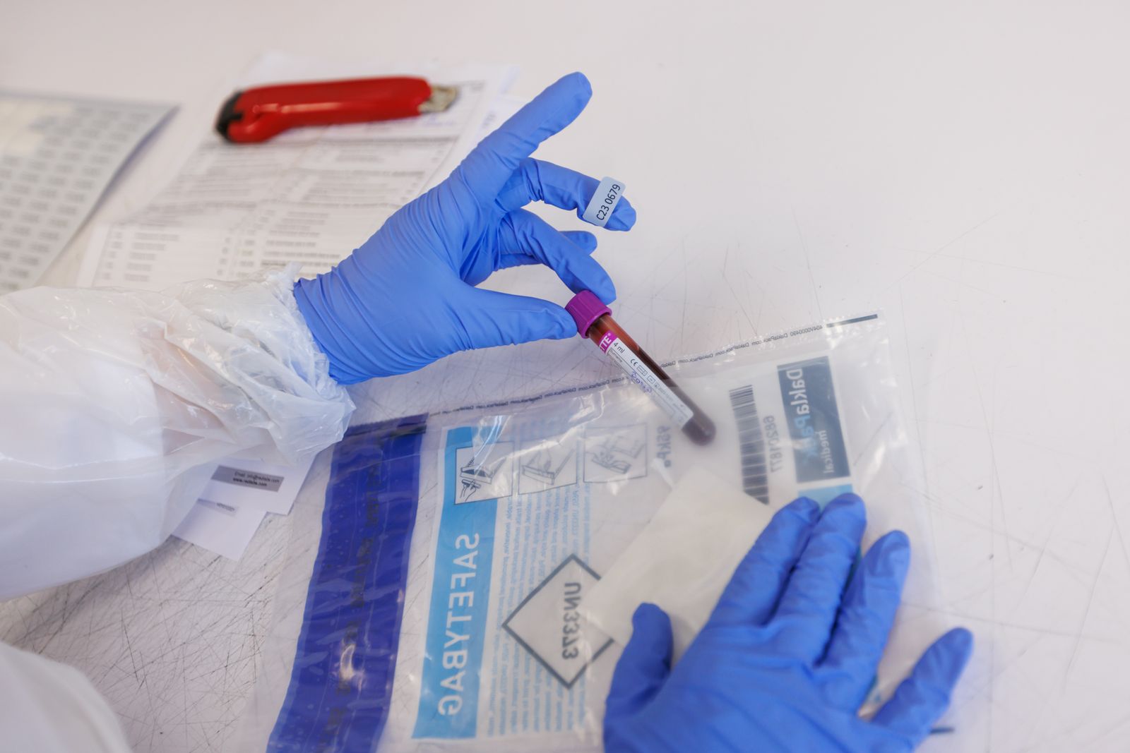 Dysfonctionnement immunitaire