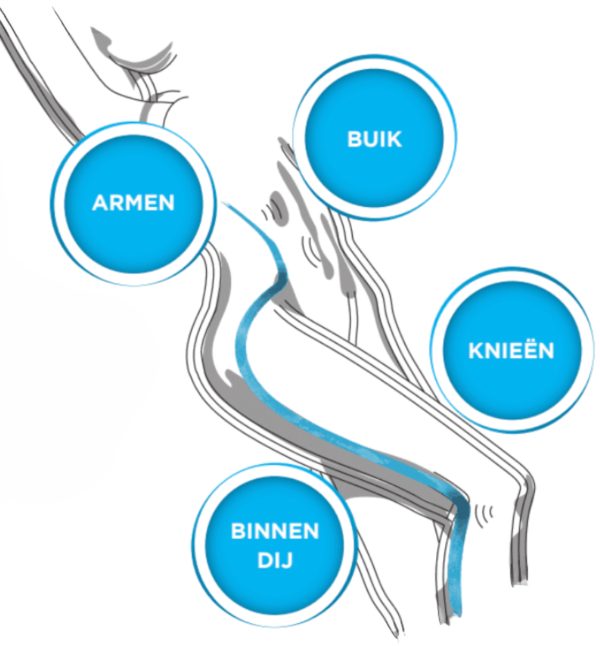 Behandelgebieden Sunekos Body