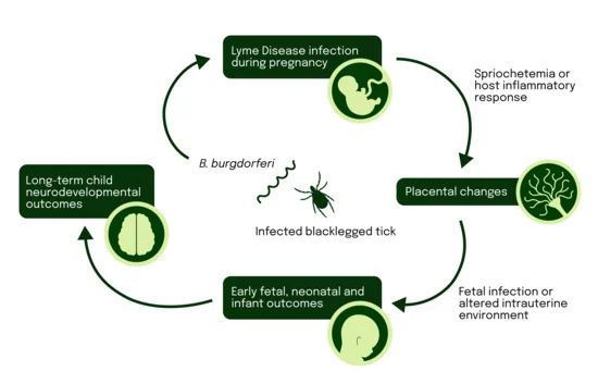 Examining Infant and Child Neurodevelopmental Outcomes After Lyme Disease During Pregnancy